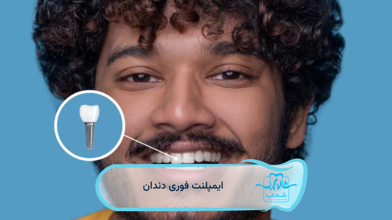 Immediate dental implants