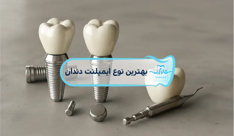 best type dental implant