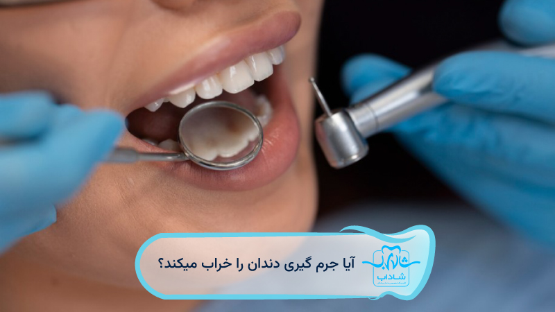 does scaling damage teeth