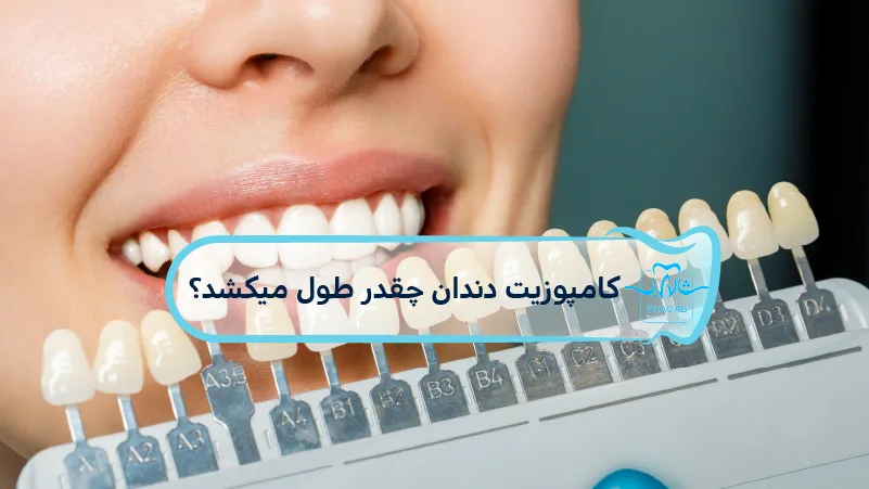 how long dental composite last
