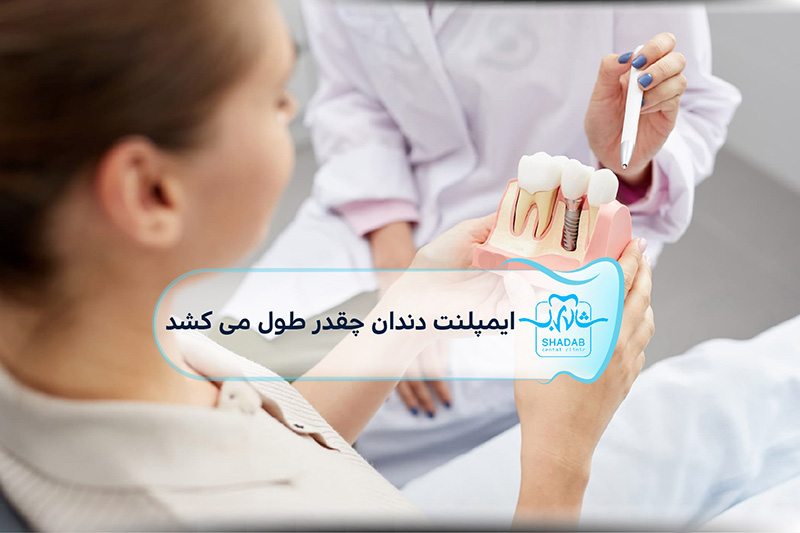 how long does dental implant procedure take