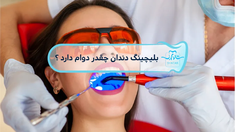 how long does teeth whitening last