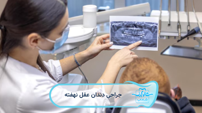 impacted wisdom tooth surgery