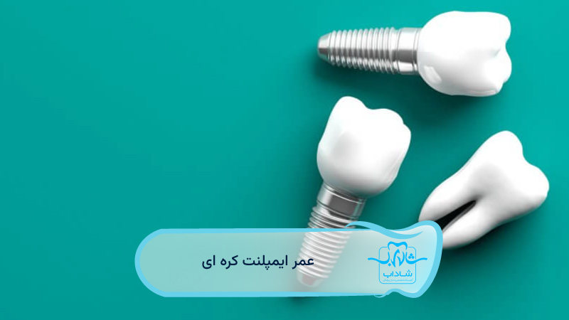 korean dental implant lifespan