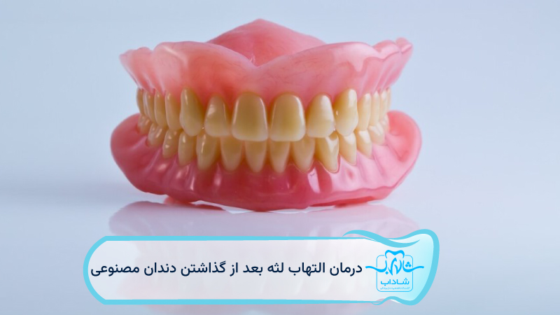 treatment gingivitis after dentures