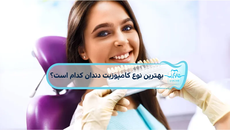 what is the best type dental composite